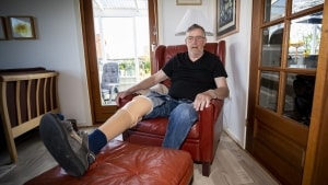72-årige Svend Dalsgaard Pedersen fra Viborg fik i 2019 fik amputeret sit højre underben. Foto: Johnny Pedersen/Jysk Fynske Medier