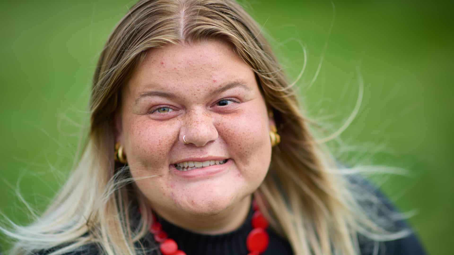 Signe Sande Signe fra Hvide Sande om sin uhelbredelige sygdom: Det er en konstant ...