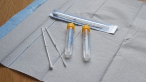 Langt flere burde blive testet med et testkit som dette, der bruges til at pode for klamydia og gonoré. Arkivfoto: Ida Marie Kristensen
