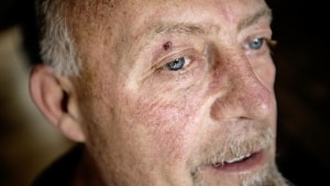 Anfaldene af Hortons hovedpine kan komme ud af det blå. Andre gange ligger der et latent anfald, som gør Ronny Falkenhard tung i hovedet og rødspættet på kindbenet. Han får et rødt øje, mens både øje og næse løber i vand. Foto: Morten Pape
