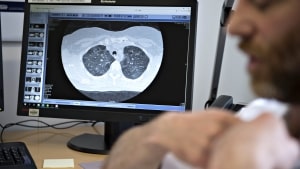 Personer med lungesygdom er nogle af dem, der kan være i øget risiko for alvorlig covid-forløb. Arkivfoto: Michael Bager