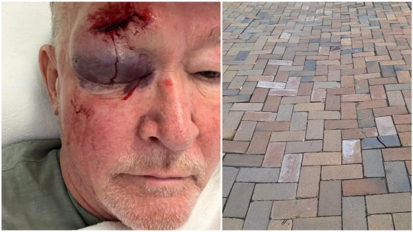 Ruben knaldede hovedet i jorden, da han snublede på farligt fortov: - Det er meget kritisabelt